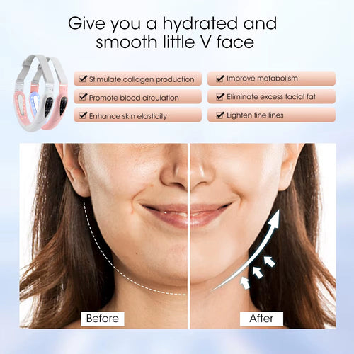 FaceliftPro X™ – The Original V-Line Lifting Device | Now with Power Upgrade